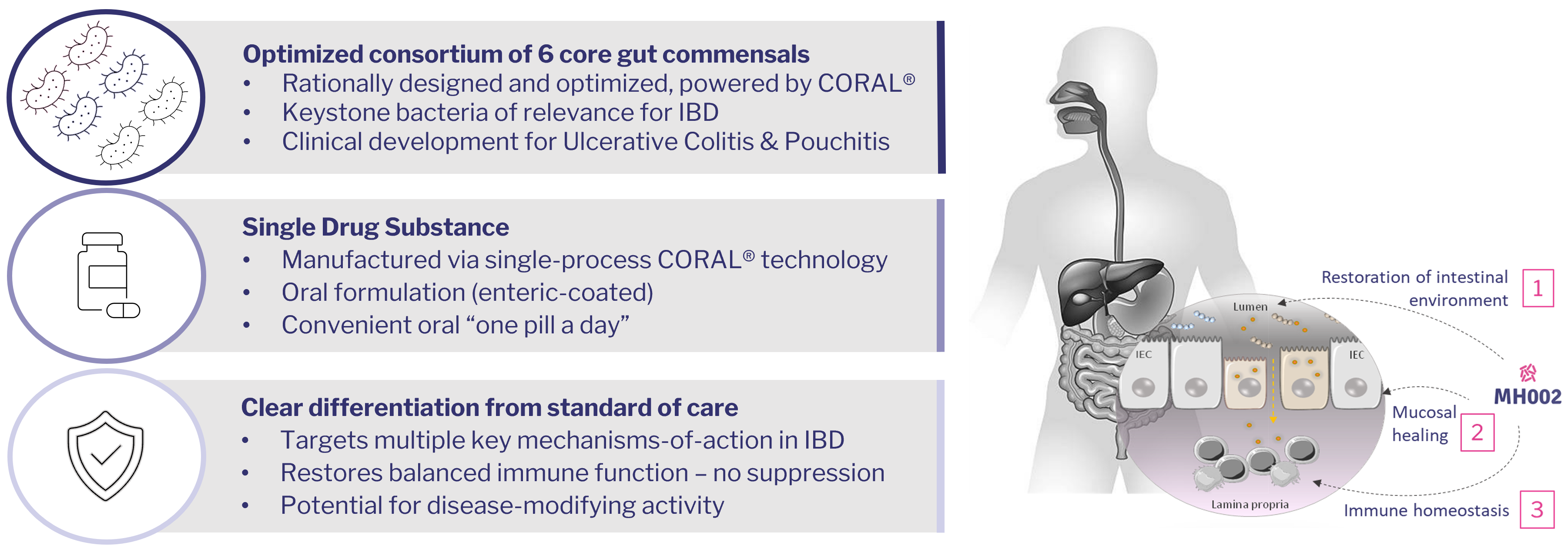 microbiome therapeutics Ulcerative colitis Crohn's disease treatment IBD